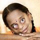 Ein Jahr lang musste sich Durga mehreren Operationen unterziehen, um heute erstmalig lächeln zu können.