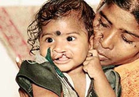 Jedes Jahr werden in Indien ungefähr 25 Mio. Kinder geboren.